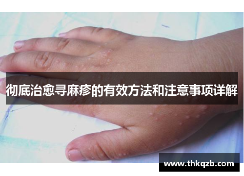 彻底治愈寻麻疹的有效方法和注意事项详解